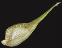 [photo of perigynia, scales and achene]